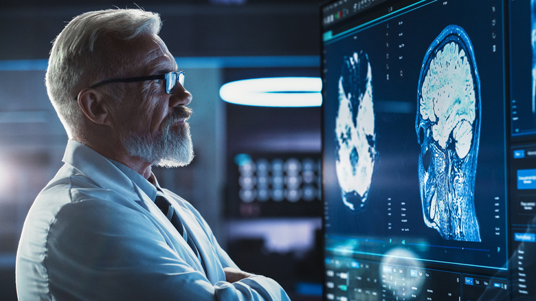 mannelijk medisch personeel kijkt naar hersenscan