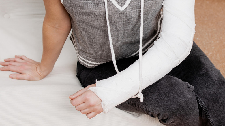 Close-up van de arm van de vrouw in het gips