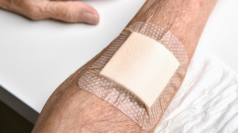Wondverband dat een arm met dunne huid bedekt