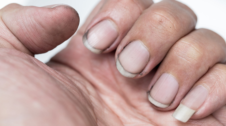 Een close-up van vuile vingernagels