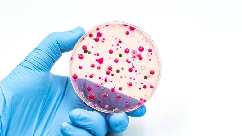 medische zorgverlener die een laboratoriumvat gevuld met bacteriën vasthoudt