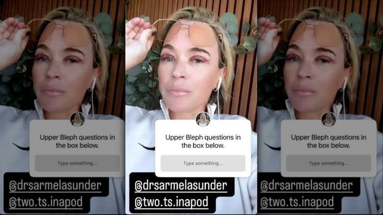 Teddi Mellencamp stelt op haar Instagram Story vragen over haar bovenste ooglidcorrectie